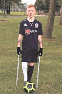 Jamie Oakey England Amputee